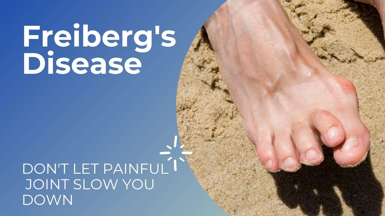 Freiberg's Disease Treatment