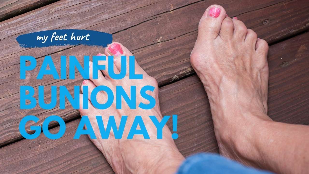 Bunion Pain