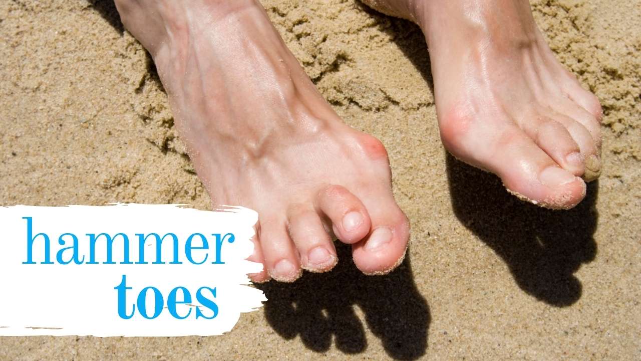 Hammertoe Pain