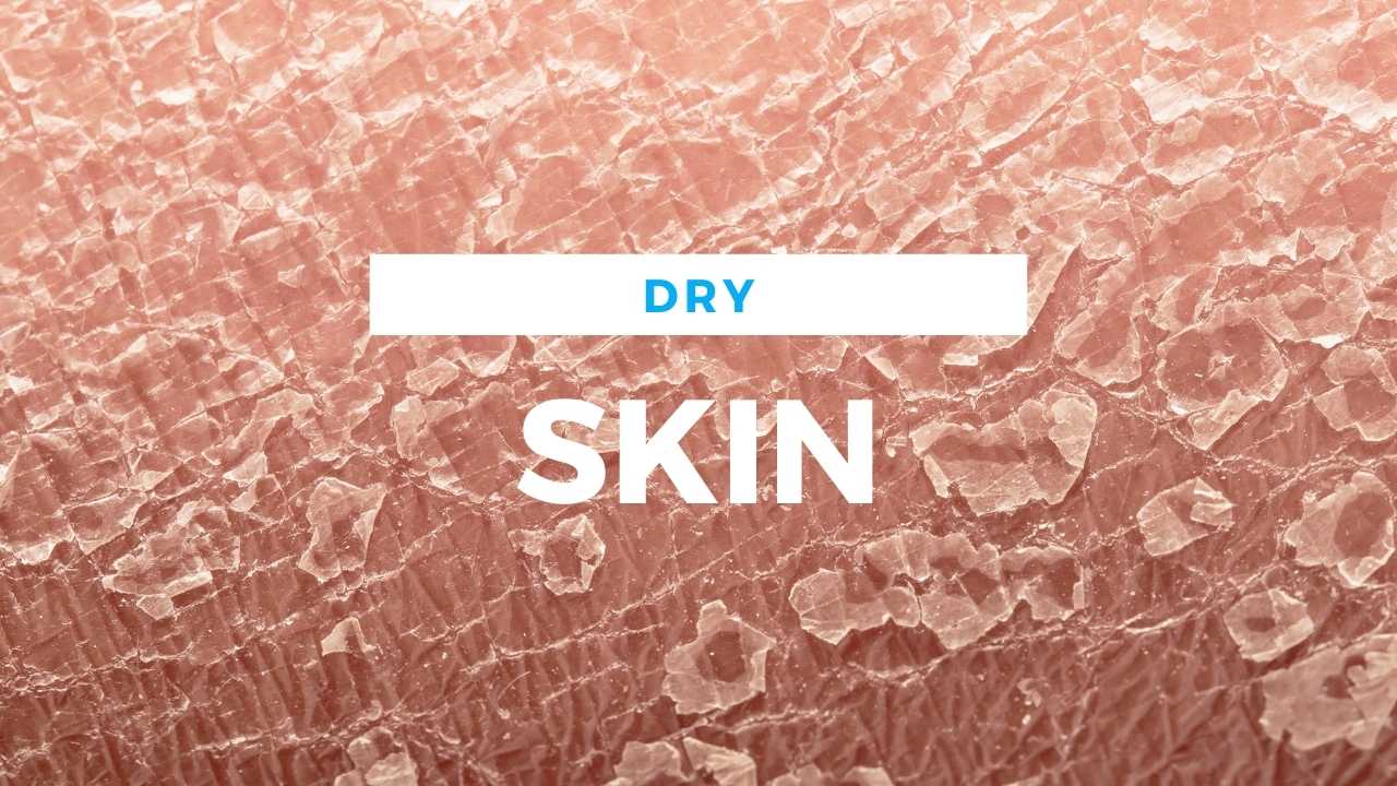Dry Skin