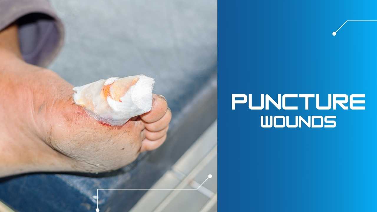 Puncture Wounds