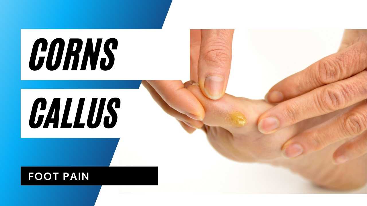 Corns and Callus Treatment